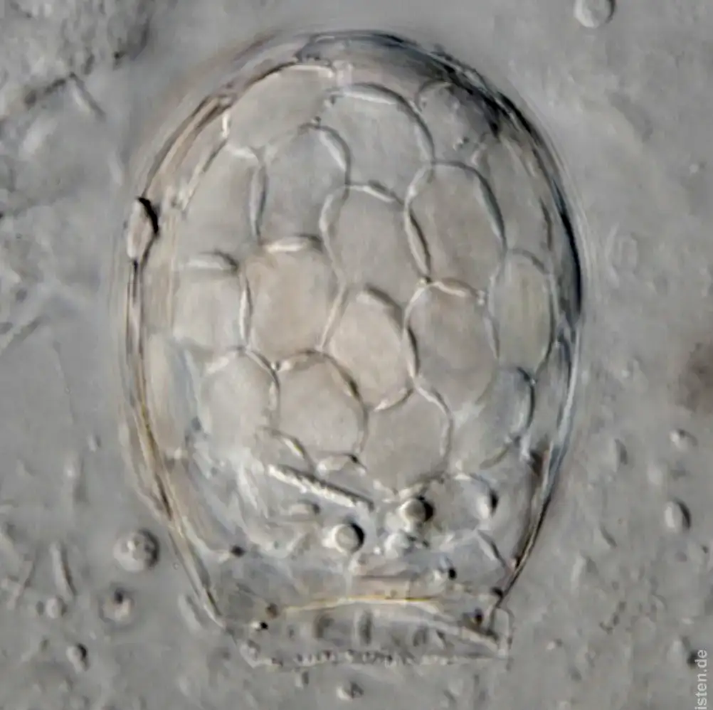 Sphenoderia labiata